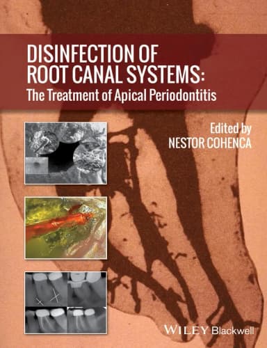 Image of - Disinfection of Root Canal Systems | Hardcover