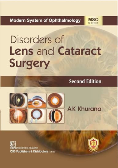 Image of - Disorders Of Lens And Cataract Surgery 2nd Edition | HardcoverMso Series