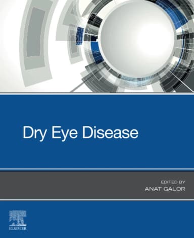 Image of - Dry Eye Disease | Paperback