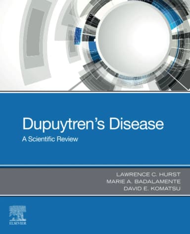 Image of - Dupuytrens Disease A Scientific Review | Paperback