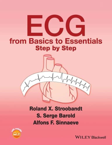 Image of - ECG from Basics to Essentials Step by Step | Paperback