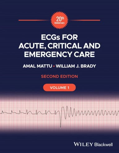 Image of - Ecgs For Acute Critical And Emergency Care 2Nd Volume 1 | Paperback