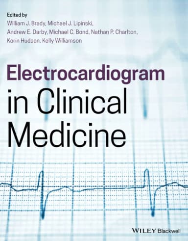 Image of - Electrocardiogram In Clinical Medicine | Paperback