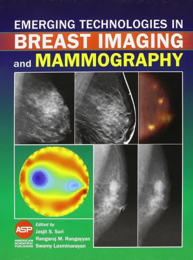 Image of - Emerging Technologies In Breast Imaging And Mammography | Hardcover