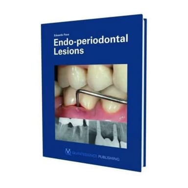 Image of - Endo-periodontal Lesions | Hardcover