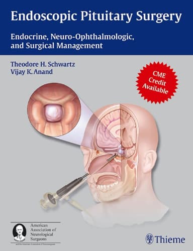 Image of - Endoscopic Pituitary Surgery | Hardcover