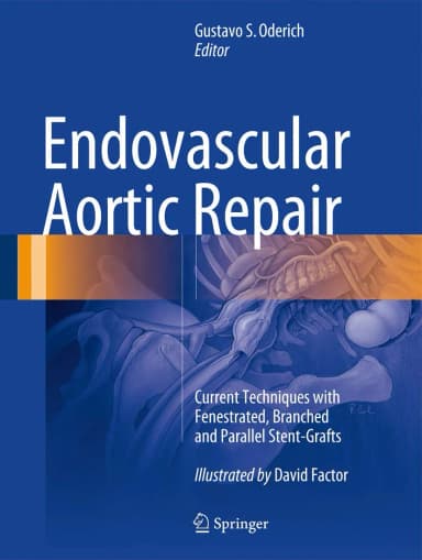 Image of - Endovascular Aortic Repair | Hardcover