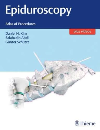 Image of - Epiduroscopy Atlas of Procedures | Hardcover