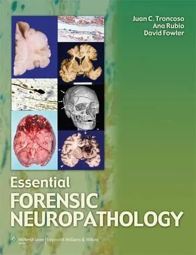 Image of - Essential Forensic Neuropathology | Hardcover