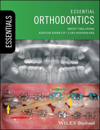 Image of - Essential Orthodontics | Paperback