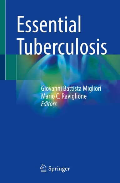 Image of - Essential Tuberculosis | Paperback