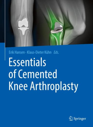 Image of - Essentials of Cemented Knee Arthroplasty | Hardcover