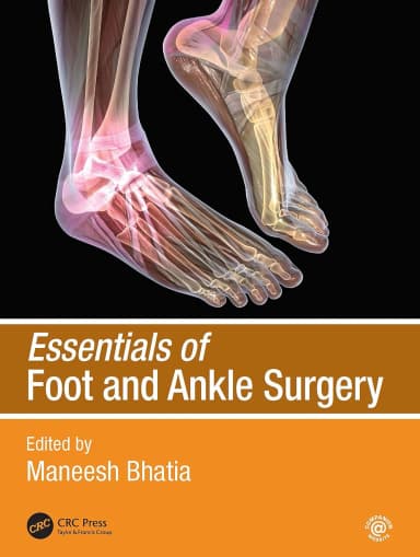 Image of - Essentials Of Foot And Ankle Surgery | Paperback