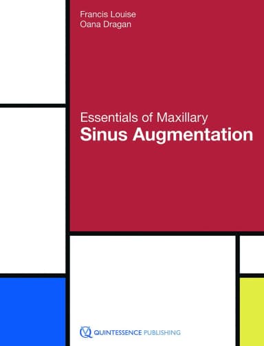 Image of - Essentials of Maxillary Sinus Augmentation | Hardcover