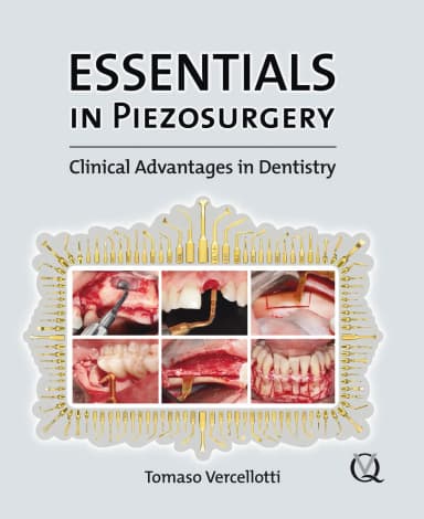 Image of - Essentials in Piezosurgery Clinical Advantages in Dentistry | Hardcover