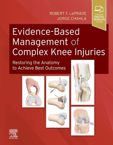 Image of - Evidence Based Management Of Complex Knee Injuries With Access Code | Hardcover