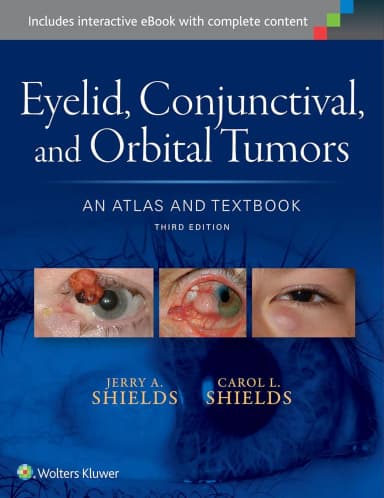 Image of - Eyelid | Conjuctival | and Orbital Tumors | Third Edition | Hardcover