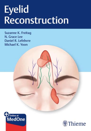 Image of - Eyelid Reconstruction | Hardcover