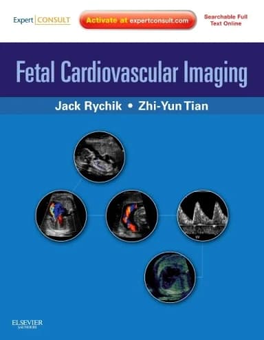 Image of - Fetal Cardiovascular Imaging | Hardcover