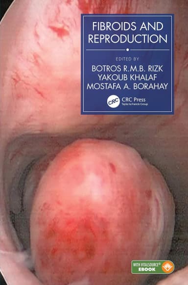 Image of - Fibroids And Reproduction | Hardcover
