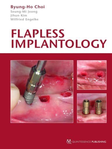 Image of - Flapless Implantology | Hardcover