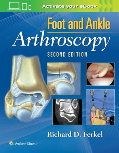 Image of - Foot and Ankle Arthroscopy | 2nd Edition | Hardcover
