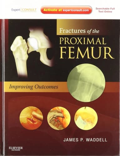 Image of - Fractures of the Proximal Femur Improving Outcomes | Hardcover