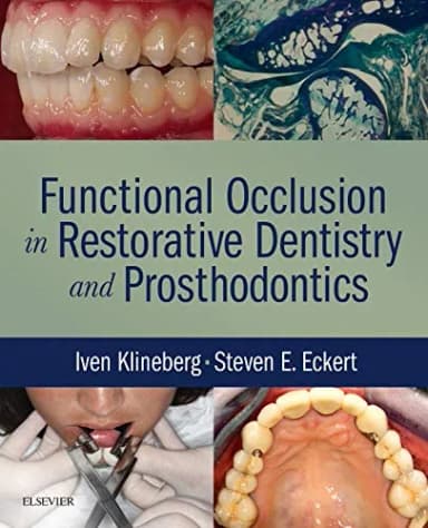 Image of - Functional Occlusion in Restorative Dentistry and Prosthodontics | Hardcover