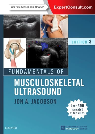 Image of - Fundamentals of Musculoskeletal Ultrasound | Third Edition | Paperback