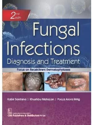 Image of - Fungal Infections Diagnosis And Treatment | 2nd Edition | Hardcover