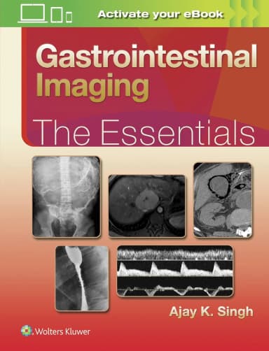 Image of - Gastrointestinal Imaging The Essentials | Hardcover
