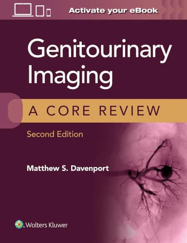 Image of - Genitourinary Imaging A Core Review 2nd Edition | Paperback