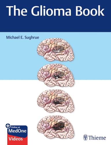 Image of - The Glioma Book | Hardcover