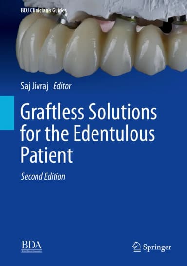 Image of - Graftless Solutions For The Edentulous Patient 2nd Edition | Hardcover