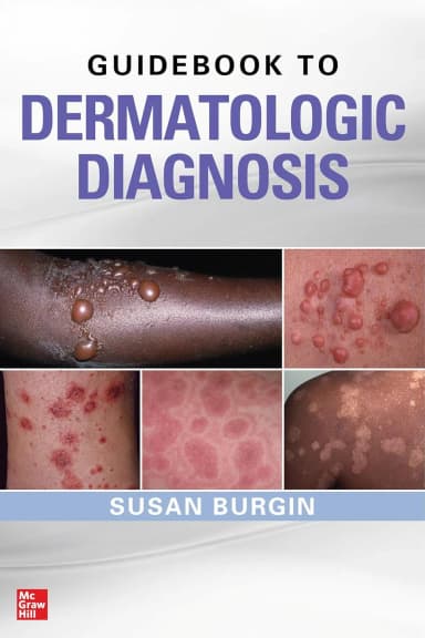 Image of - Guidebook To Dermatologic Diagnosis | Paperback