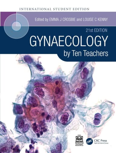 Image of - Gynaecology By Ten Teachers | 21E (Ise) | Paperback