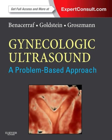 Image of - Gynecologic Ultrasound A Problem Based Approach | Hardcover
