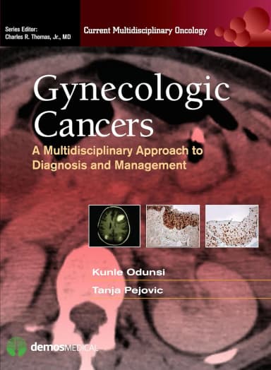 Image of - Gynecology Cancers | Hardcover