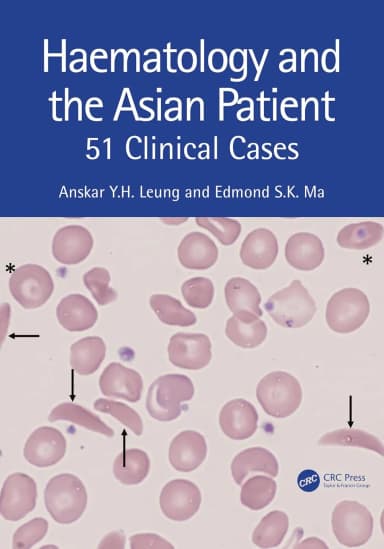 Image of - Haematology And The Asian Patient 51 Clinical Cases | Paperback