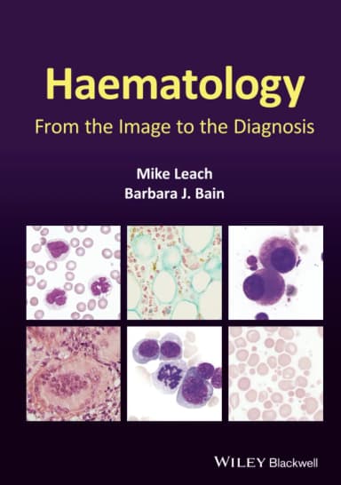 Image of - Haematology From The Image To The Diagnosis | Hardcover