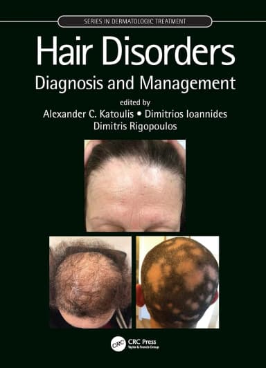 Image of - Hair Disorders Diagnosis And Management | Hardcover