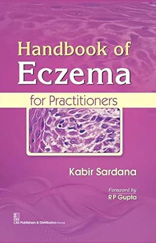 Image of - Handbook of Eczema for Practitioners | Hardcover