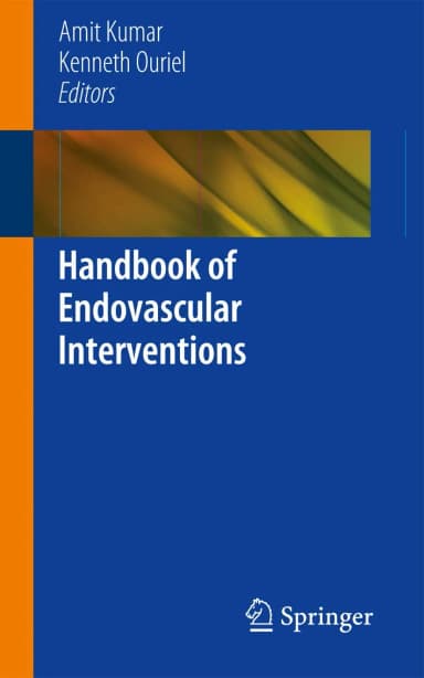 Image of - Handbook of Endovascular Interventions | Paperback