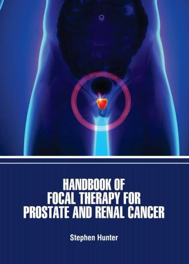 Image of - Handbook Of Focal Therapy For Prostate And Renal Cancer | Hardcover
