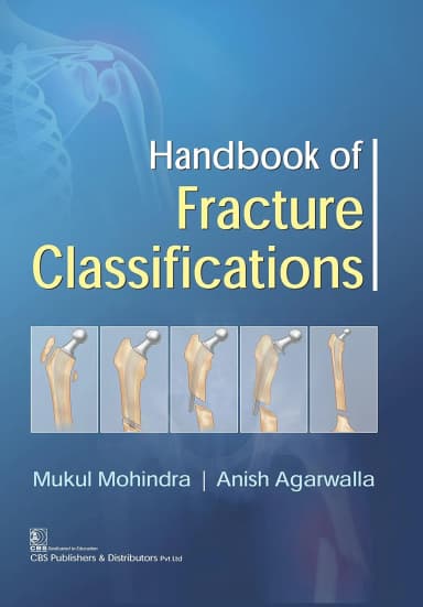 Image of - Handbook of Fracture Classifications | Paperback