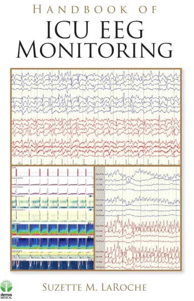 Image of - Handbook of ICU EEG Monitoring | Paperback