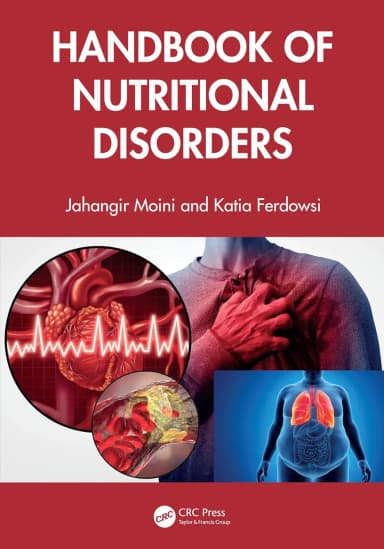 Image of - Handbook Of Nutritional Disorders | Paperback