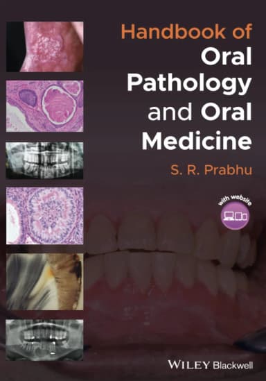 Image of - Handbook Of Oral Pathology And Oral Medicine | Paperback