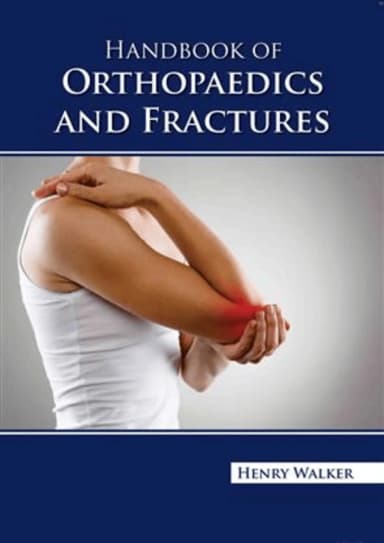 Image of - Handbook Of Orthopedics And Fractures | Hardcover