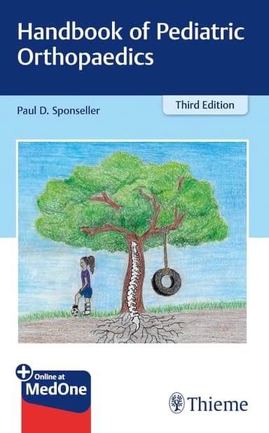 Image of - Handbook of Pediatric Orthopaedics | Third Edition | Paperback
